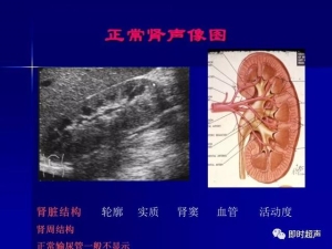 泌尿系统生理病理诊断数据 泌尿系统病超声诊断3