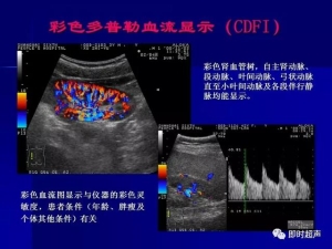 泌尿系统生理病理诊断数据 泌尿系统病超声诊断5