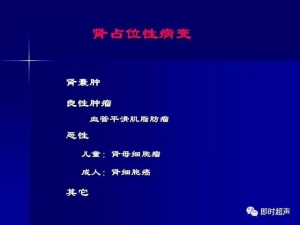 泌尿系统生理病理诊断数据 泌尿系统病超声诊断13