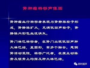 泌尿系统生理病理诊断数据 泌尿系统病超声诊断24