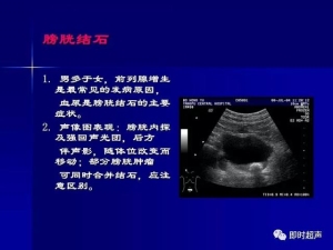 泌尿系统生理病理诊断数据 泌尿系统病超声诊断30