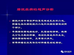 泌尿系统生理病理诊断数据 泌尿系统病超声诊断31