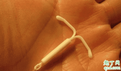 上完环月经变少了是咋怎么回事节育环放久了会月经不调吗？