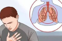 咳嗽怎么治最快最有效咳嗽快速止咳小妙招