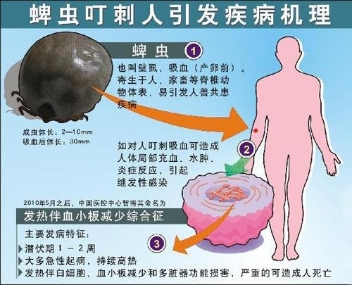 老太被蜱虫叮咬去世 四名亲属感染：多地开始进入活跃期