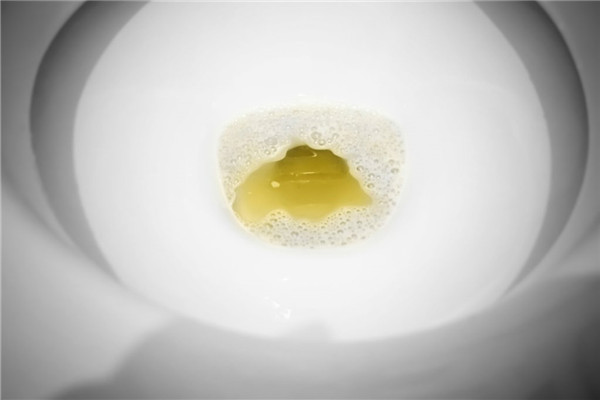 尿液有泡沫正常吗 三种尿液情况要重视 尿液有泡沫正常吗 三种尿液情况要重视