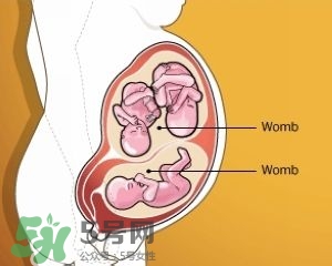 双子宫是什么意思？双子宫可以顺产吗？