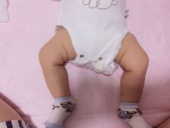 腿部也能看出健康问题宝宝双腿出现这3种情