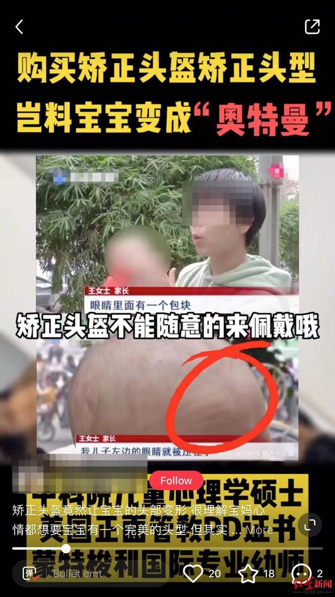 家长不要再给孩子戴它了医生：影响发育